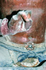 25to29Fig012 N26 CL94 92 18
