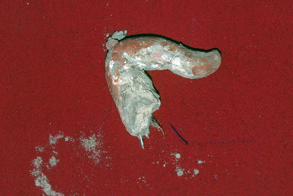 25to29Fig056 N29 CL94 89 11